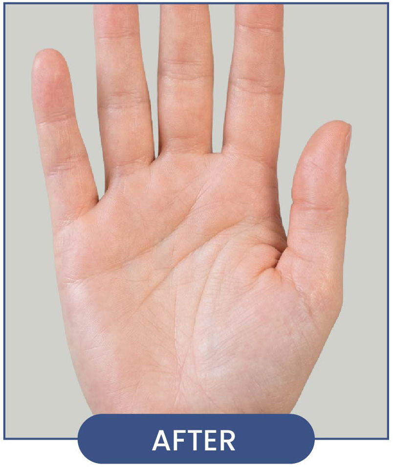 Transformative Results after