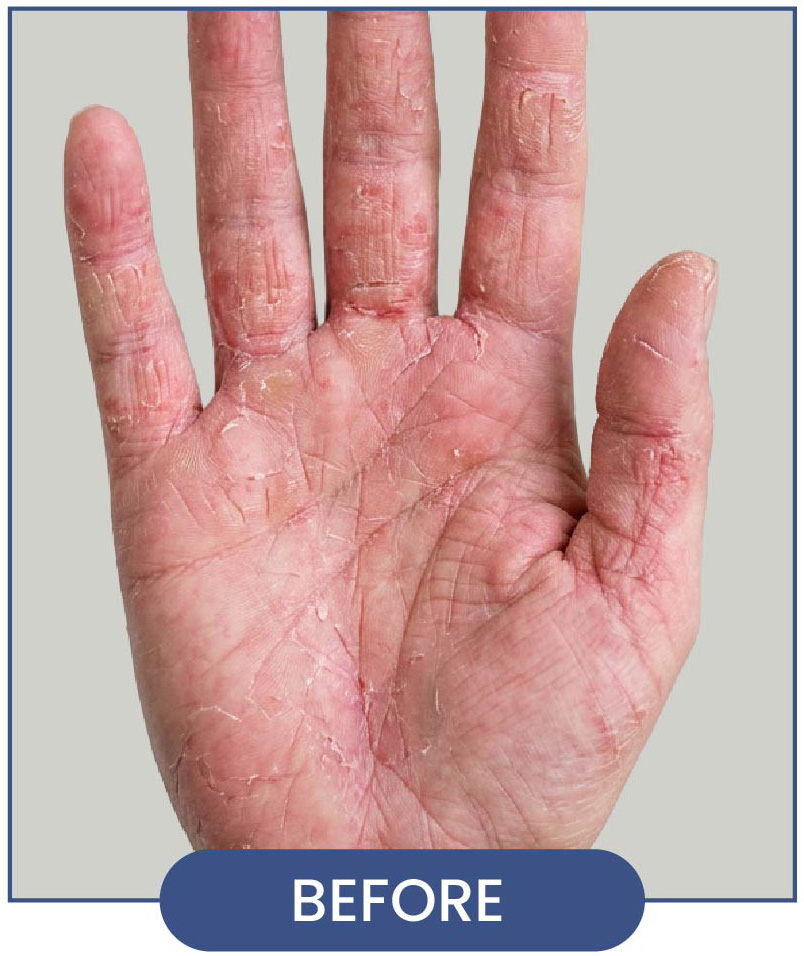Transformative Results before